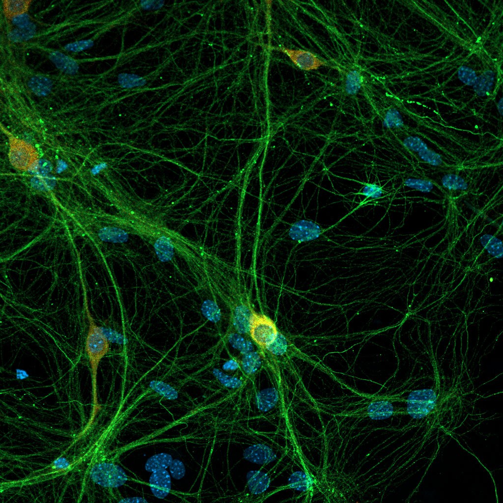Нейроны и астроциты